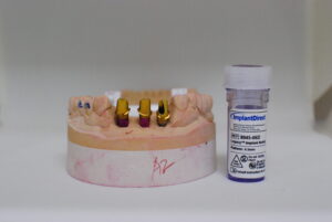 implant abutment