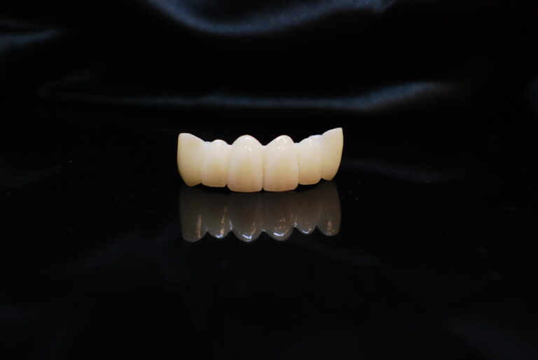 layered zirconia 11 (10)