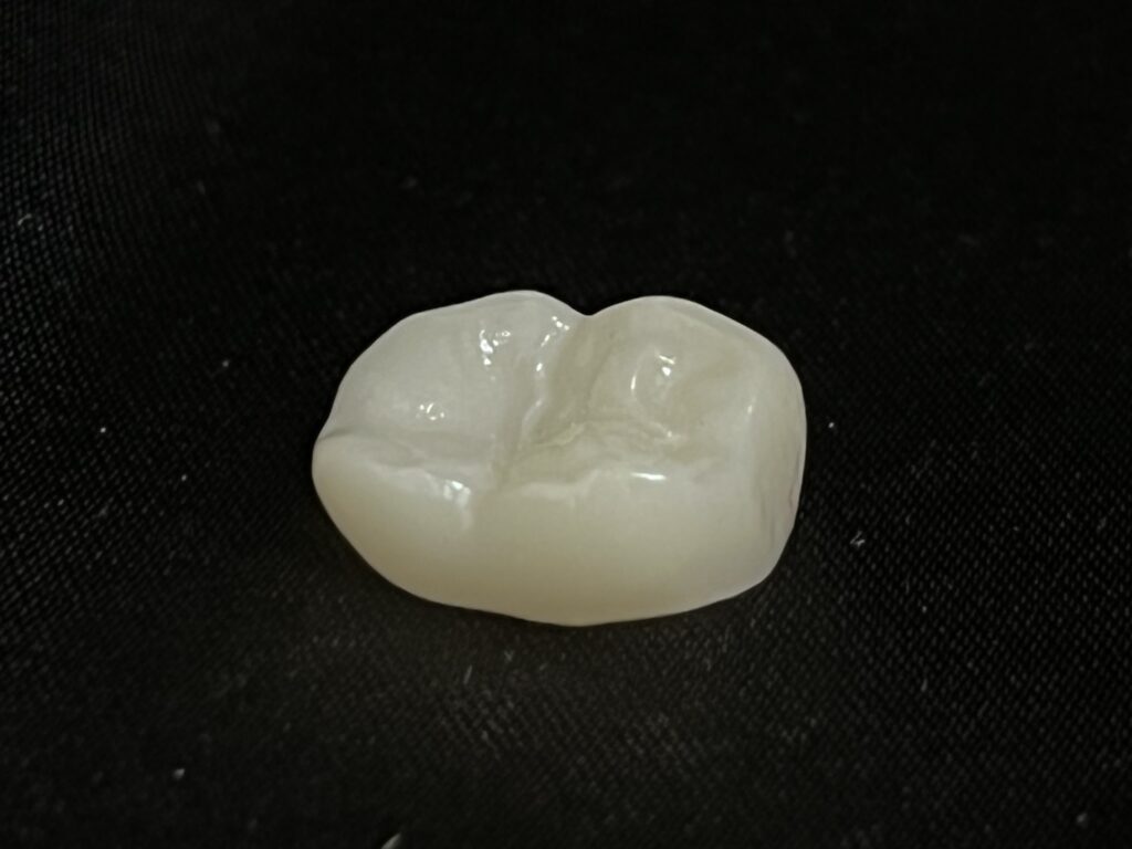 solid zirconia crown