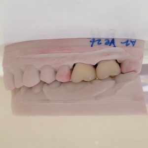 DIGITAL CROWN ON MODEL ( FROM T DIE)