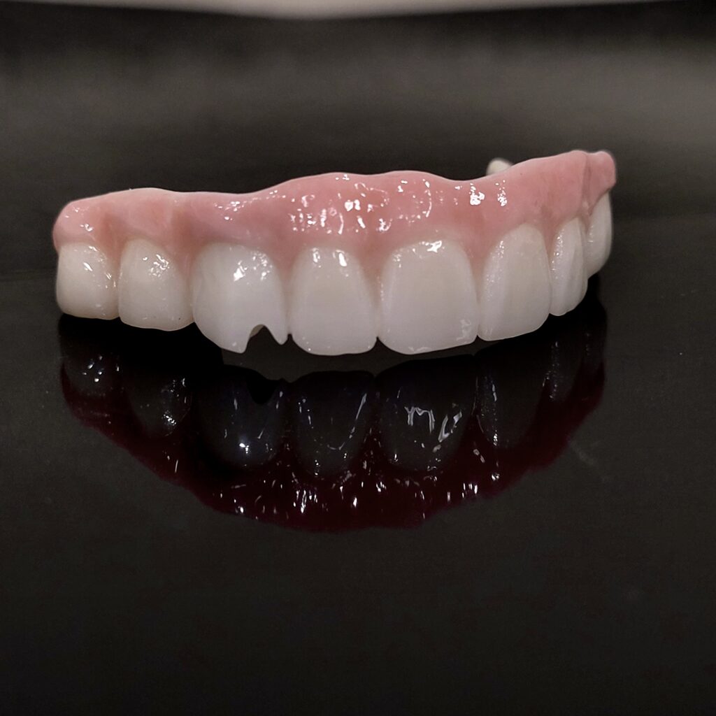 MUA Final Zirconia Bridge