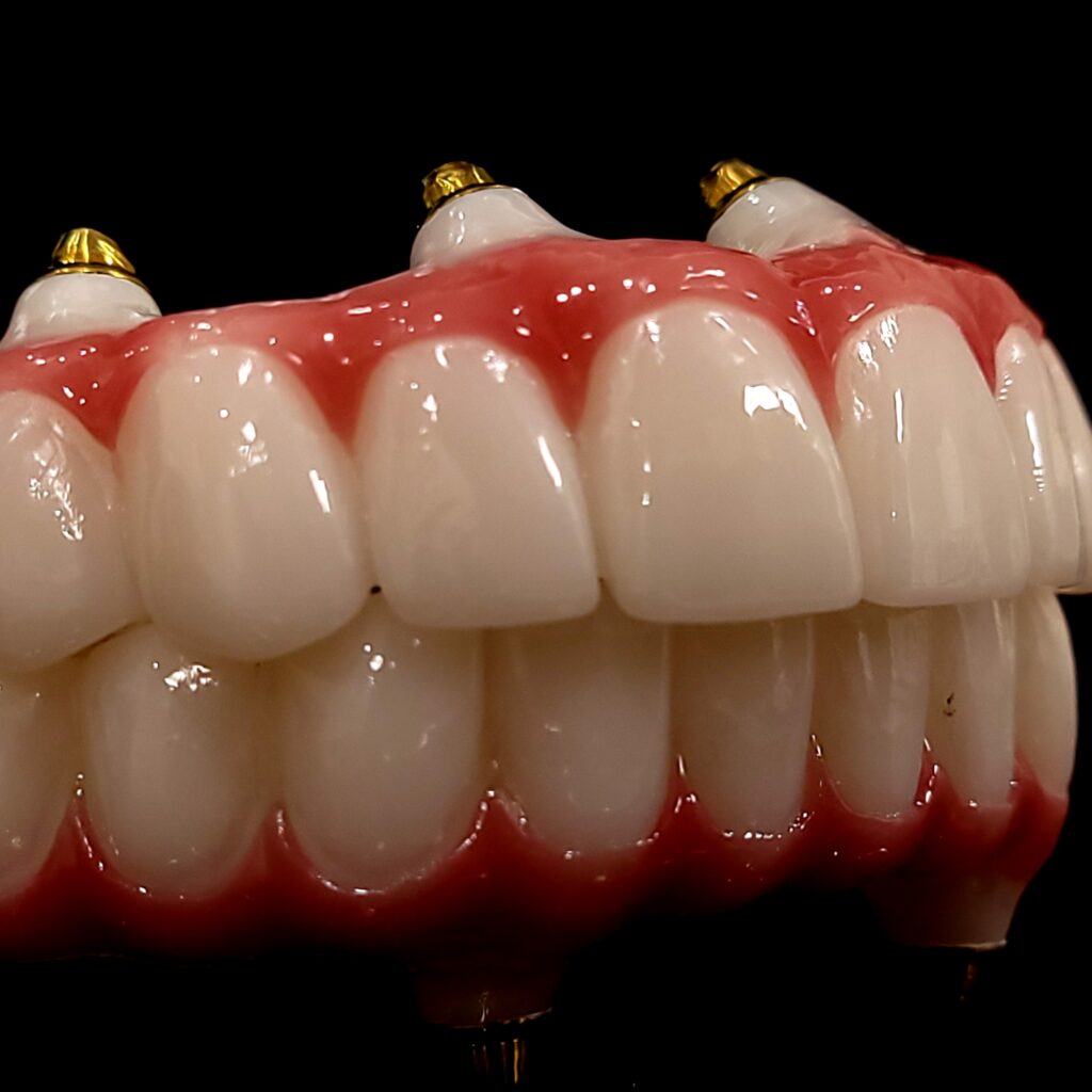 Upper and Lower final Zirconia arch