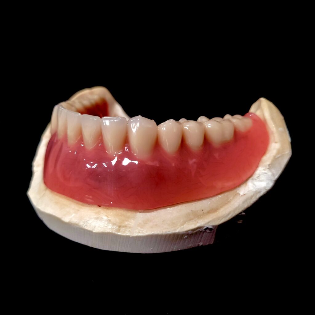 Lower Locator Finished (4)  on Model