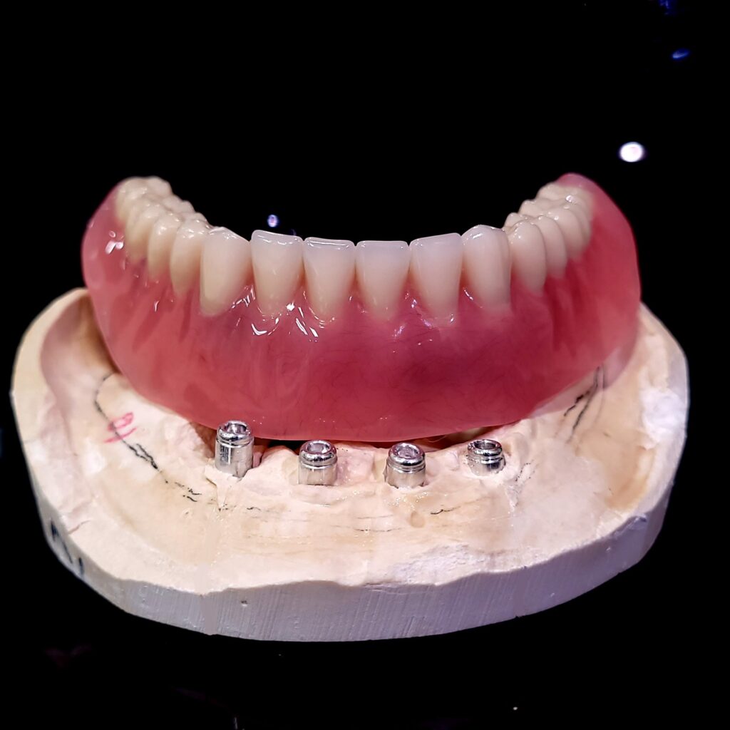 Lower Locator Finished (4)