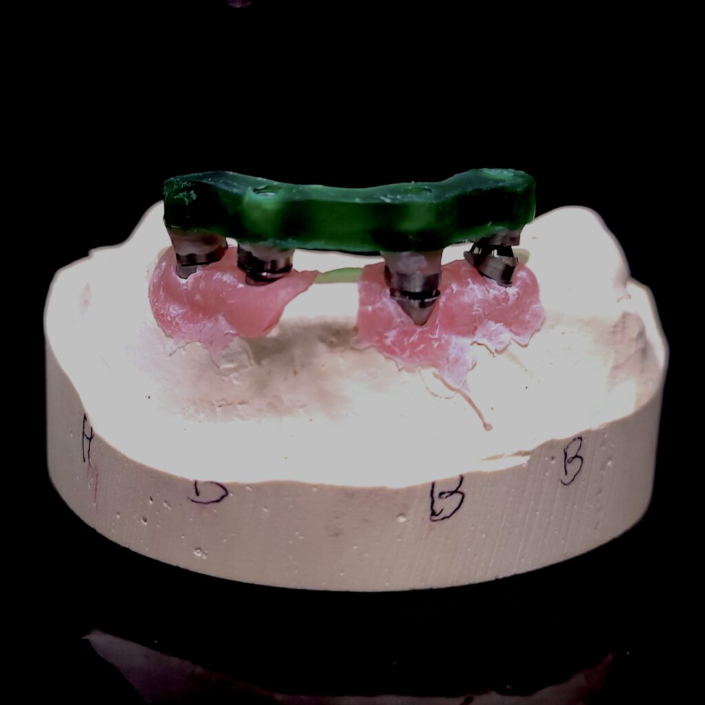 MUA abutment with verification jig
