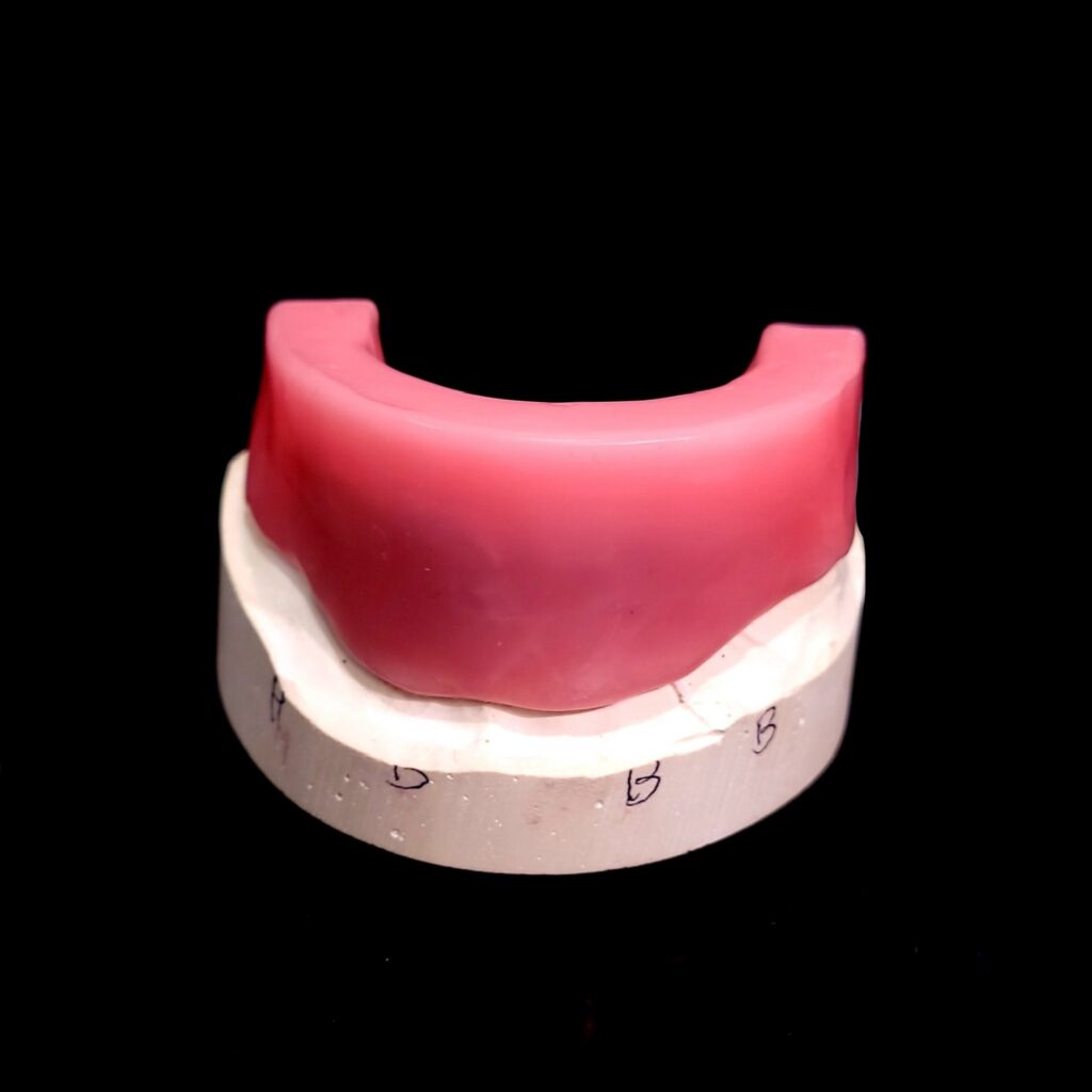 Wax rim fit with jig