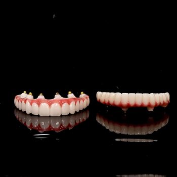 Upper all on 6, Lower all on 4 arches