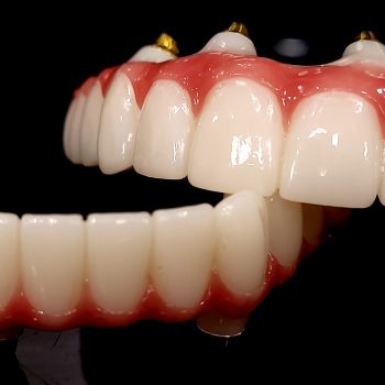 FINAL ZIRCONIA UPPER AND LOWER BB (8)