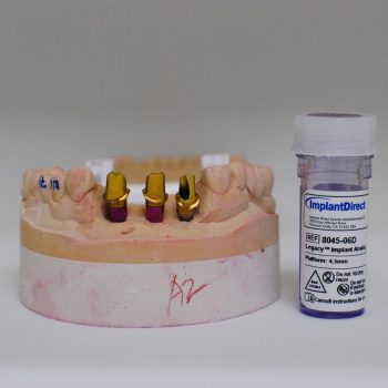implant abutment