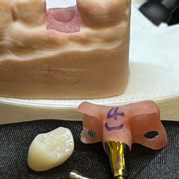 verification jig and crown